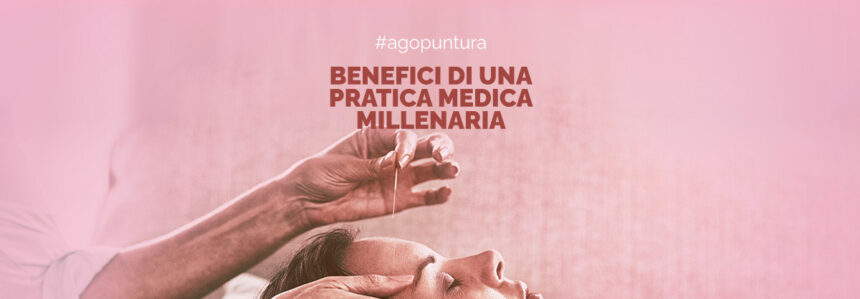 Agopuntura: i benefici di una pratica medica millenaria